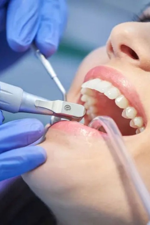 Limpeza dental com ultrassom
